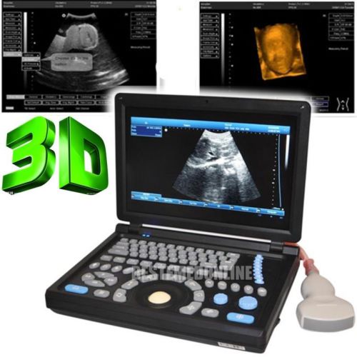 NEW 10.4&#034; 3D PC platform Full Digital Laptop Ultrasound Scanner+ 3.5Convex Probe