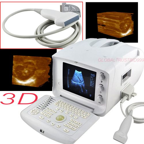 CE Portable digital Ultrasound Scanner machine 7.5MHZ Linear probe w external 3D