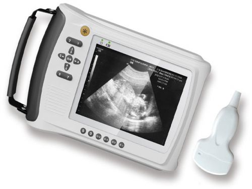 Veterinary Digital Ultrasound Scanner with 3.5MHZ/6.5MHZ/5.0MHZ Probe Options