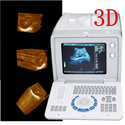 Full digital portable laptop ultrasound scanner machine + 3.5mhz convex probe for sale
