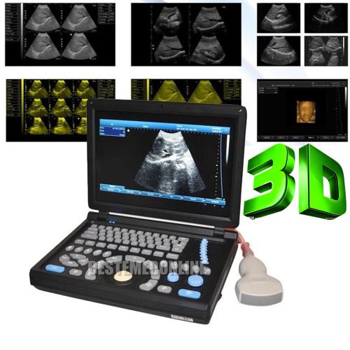 in 3D Full Digital Laptop Ultrasound Scanner (PC) with convex probe Free Ship