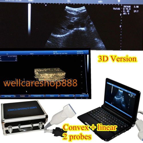 FELL Digital Laptop Ultrasound Scanner Machine+Convex+Linear+3D USB 9000F CARE