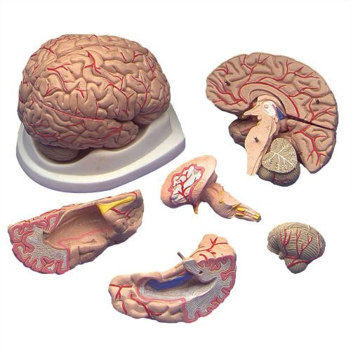 Budget Brain With Arteries Model ~ patient education/demonstration of procedures