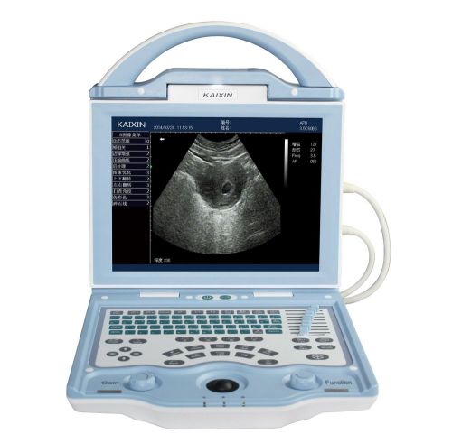 Veterinary laptop ultrasound scanner led screen 10.4&#034;,dicom ,battery,big image for sale