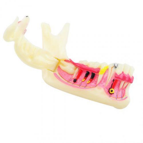 Dental Mandibular Tissue Teeth Demonstration Anatomical Model Patient Study