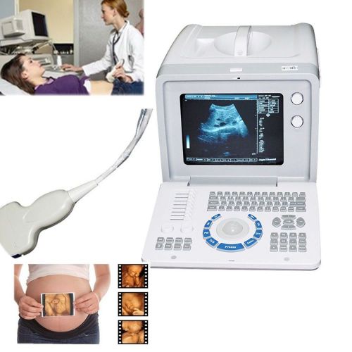 Portable ultrasound ultrasonic machine scanner system 3.5m convex transducer 3d for sale