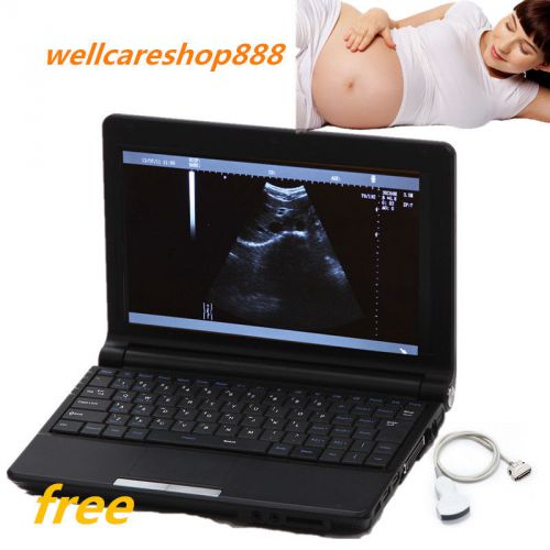 full Digital Portable Laptop Ultrasound Scanner+convex probe+3D software CE