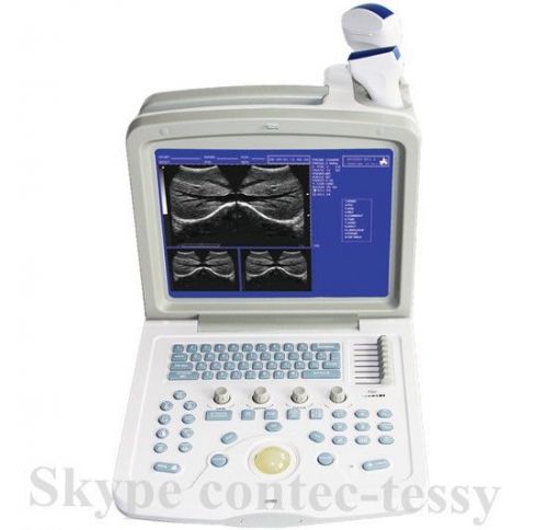 New Portable Ultrasound scanner CMS600B-3+3Probes(convex+Linear+Micro-convex),CE