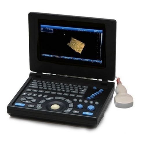 Digital Ultrasound Scanner Ultrasonic Diagnostic System(PC) 3D +Convex 10.4 inch
