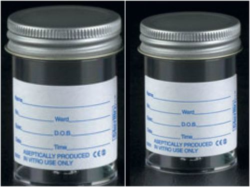 urine sample specimen bottle labeled x10- 60ml