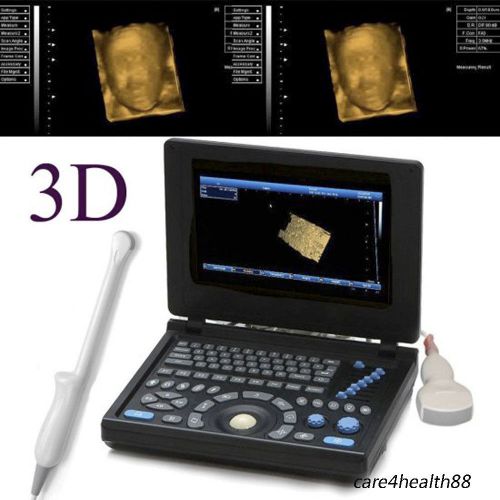 3d full digital laptop ultrasound scanner (pc) with convex probe &amp; transvaginal for sale