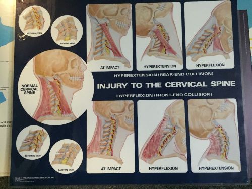Injury to the Cervical Spine poster