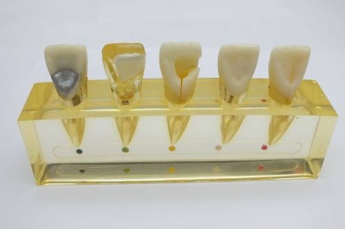 Dental Root Canal Model 5 Teeth