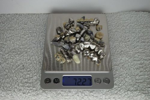 Dental scraps 72,27 grams