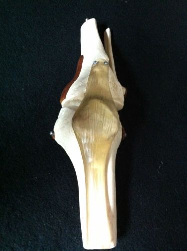 Vintage Damaged SOMSO NS50 Functional Knee Joint Anatomical Model AS-IS