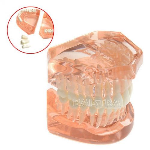 Dental Adult Typodont Model Removable Teeth Study Teaching Teeth Model ZYR-7006