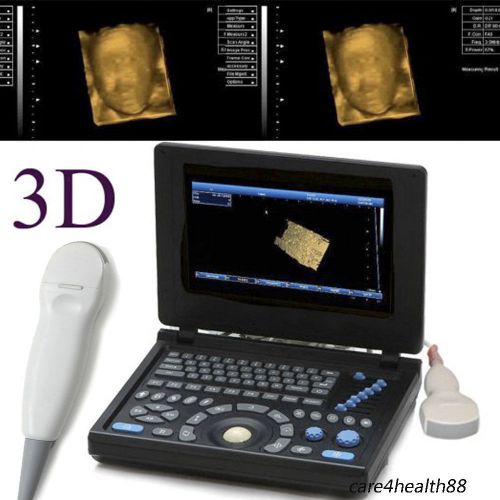 3d pc full-digital ultrasound scanner machine 3.5mhz convex +mirco-convex probe for sale