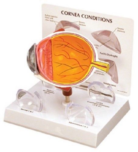 NEW Anatomical Set of 4 Cornea Eye Cross-Section Model