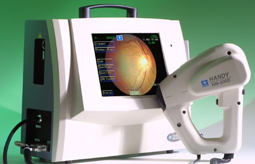 Nidek HANDY NM-200D Retinal Fundus Camera Portable 2006