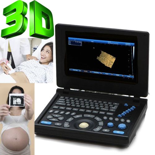 3D Full-digital Ultrasound scanner machine with 3.5MHz R60 convex +2 USB Ports
