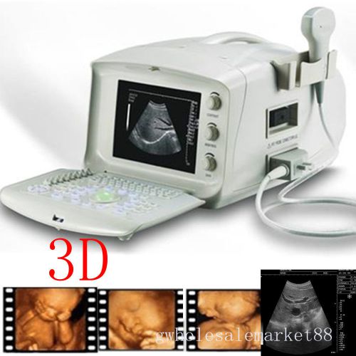 Fda full digital portable diagnose ultrasound scanner convex probe 3d 100% good for sale