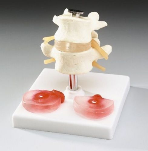 Lumbar Vertebrae Desk/Display Anatomy Model with Interchangeable Discs