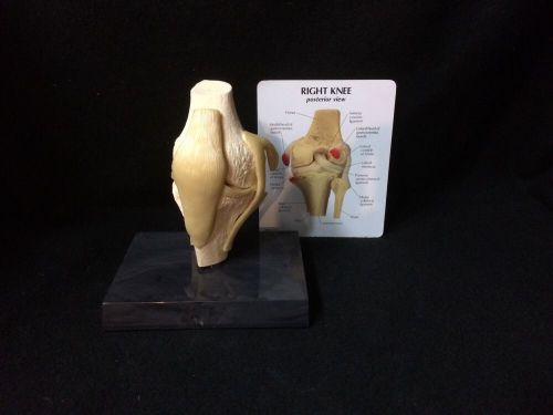 GPI #1000 - Basic Right Knee with Joints Anatomical Model Functional Knee