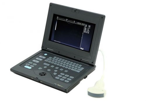 Promotion New laptop CONTEC B-ultrasound scanner with convex probe CMS600P