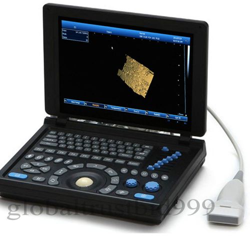 @ 3D image Full Digital Laptop Ultrasound Scanner PC+ 7.5 MHZ Linear probe