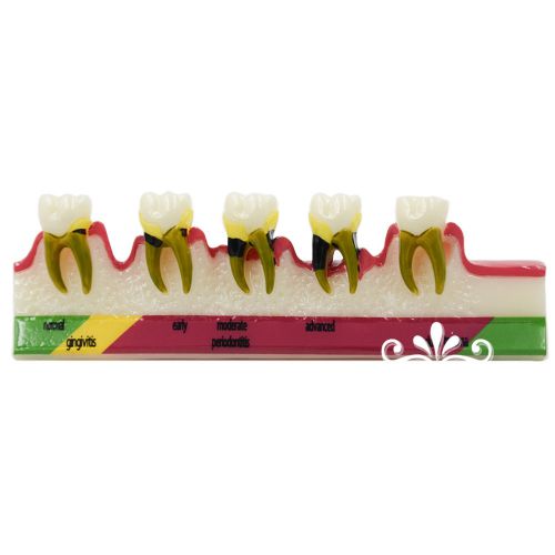 Dental Periodontal Disease Assort Typodont Tooth Teeth Study Teaching Model New