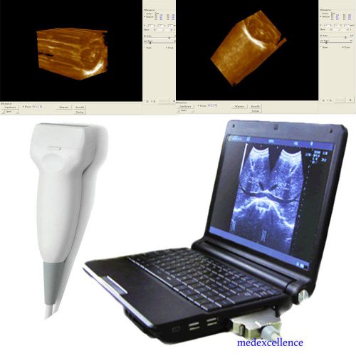 TFT LCD Notebook Laptop Digital Ultrasound machine Scanner Linear 3D