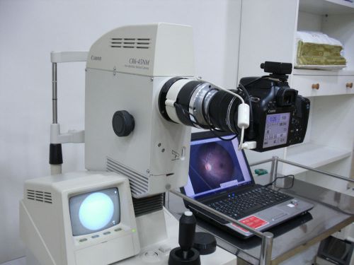 CR6-45NM NM FUNDUS CAMERA-DIGITAL CONVERTED