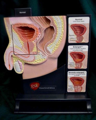 Male Pelvis Anatomical BPH Model