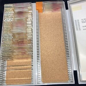 Vintage Medical Microscope Parasites Slides 44 Histology Pathology Human Tissue