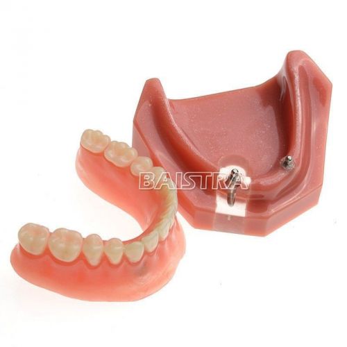 Dental 1 Pc Study Teaching Model Teeth Implant Repair Model # 6007 baistraworld