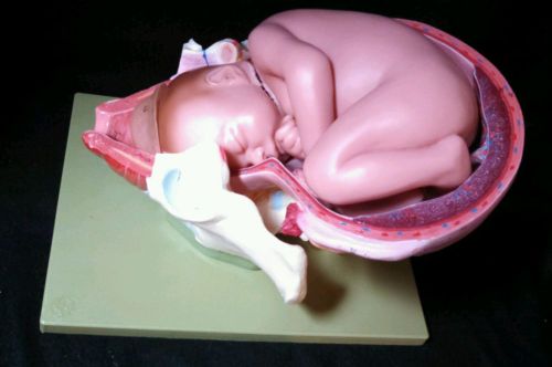 SOMSO - MS45-1 Baby First Stage of Birth Anatomical Labor Model (MS 45-1)