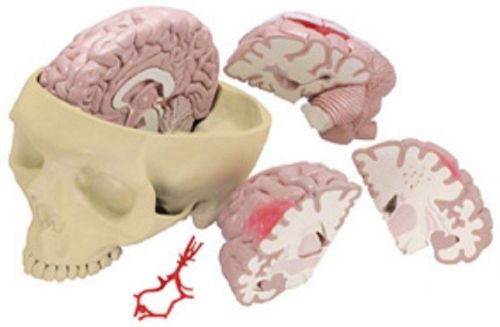 NEW Anatomical Brain &amp; Partial Skull Cranium Model