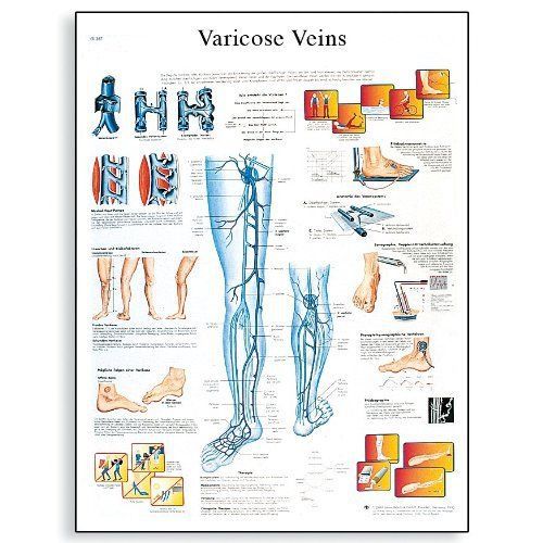 3b scientific vr1367l glossy laminated paper varicose veins anatomical chart  po for sale
