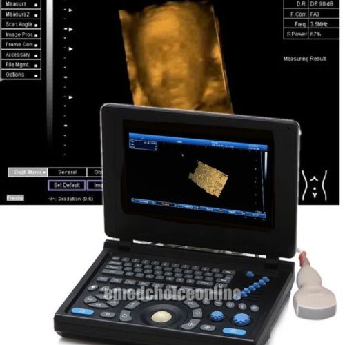 New full digital tft lcd ultrasound scanner high-resolution (built-in 3d) convex for sale