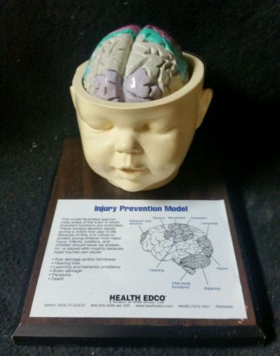 Vintage Health EDCO Anatomical Model Infant Brain &amp; Injury Prevention Model