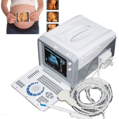 3D workstation Portable Ultrasound Scanner machine system CONVEX PROBE USB PORT