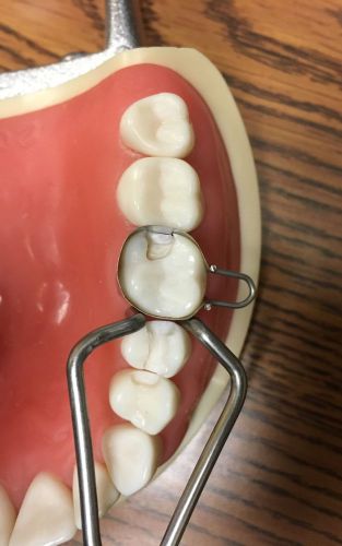 U Dental  Matrix Bands / retainers for mod  Composite/Amalgam/ Matrices