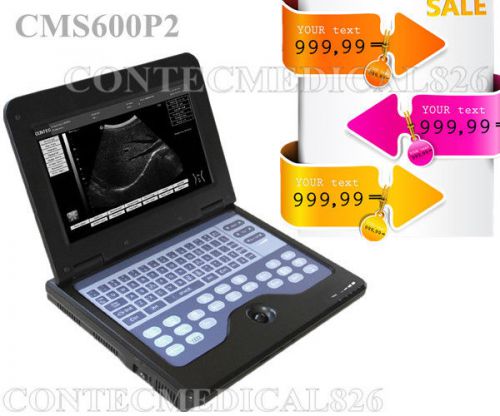 Promotion cms600p2 new portable laptop ultrasound scanner 3.5 convex,2y warranty for sale