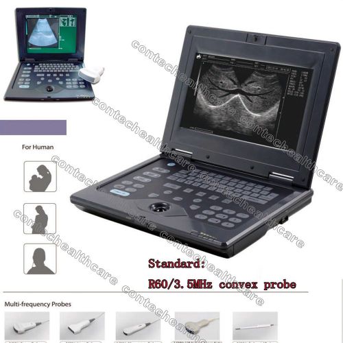 10.4&#039;TFT Color Smart Laptop Ultrasound Scanner,B-Ultrasound Machine+convex probe
