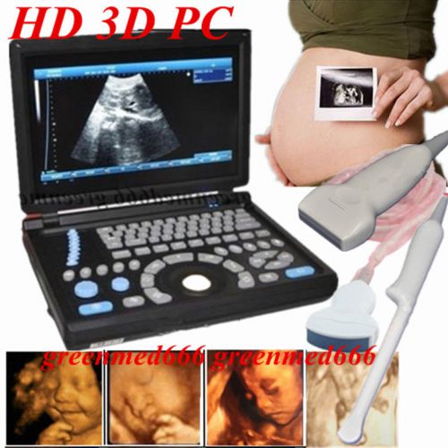 3d full digital laptop ultrasound scanner+convex &amp;transvaginal &amp;linear 3probe pc for sale