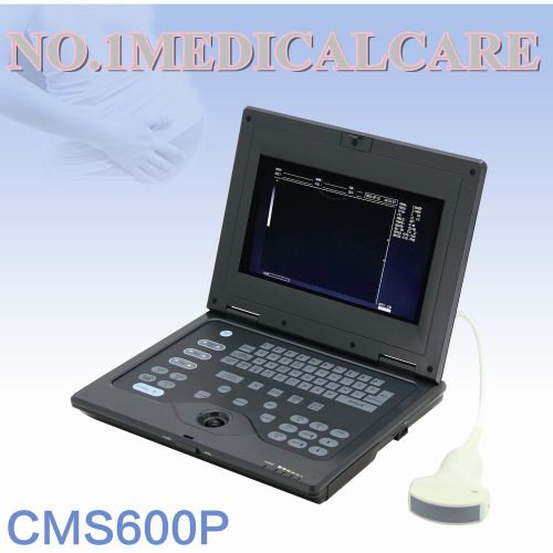 Factory direct sale-- good image laptop b-ultrasound scanner + 3.5 convex probe for sale