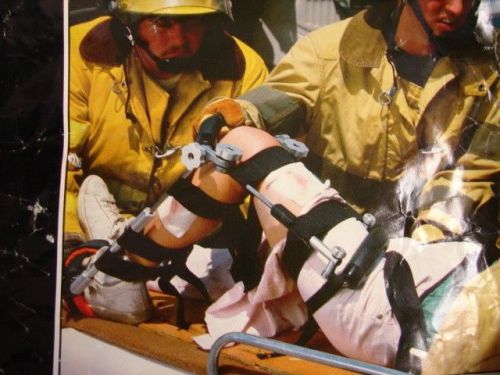 The Reel Splint Emergency Leg Splint Traction System Immobilize for extraction