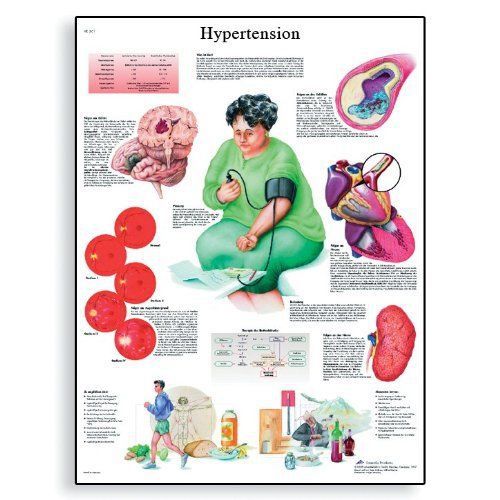 3B Scientific VR1361L Glossy Laminated Paper Hypertension Anatomical Chart  Post
