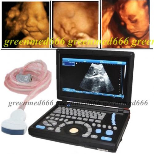 HD PC platform Notebook Digital Laptop Ultrasound Scanner 3D + Convex probe FDA