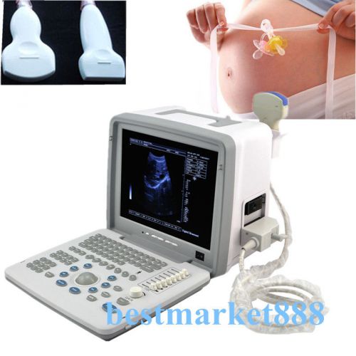 12.1 full digital portable ultrasound scanner +convex + linear (2 probe) + 3d aa for sale